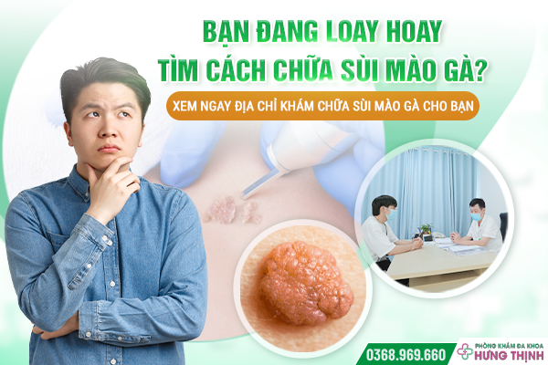 Bạn Đang Loay Hoay Tìm Cách Chữa Sùi Mào Gà? Xem Ngay Địa Chỉ Khám Chữa Sùi Mào Gà Cho Bạn
