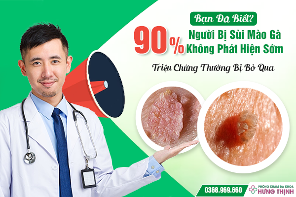 Bạn Đã Biết? 90% Người Bị Sùi Mào Gà Không Phát Hiện Sớm – Triệu Chứng Thường Bị Bỏ Qua