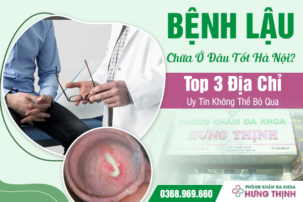 Bệnh Lậu Chữa Ở Đâu Tốt Hà Nội? Top 3 Địa Chỉ Uy Tín Không Thể Bỏ Qua