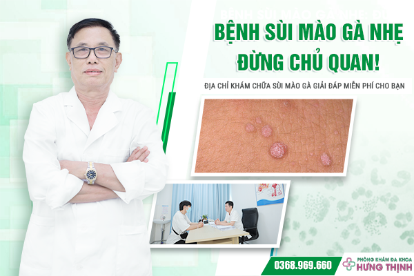 Bệnh Sùi Mào Gà Nhẹ: Đừng Chủ Quan! Địa Chỉ Khám Chữa Sùi Mào Gà Giải Đáp Miễn Phí Cho Bạn 