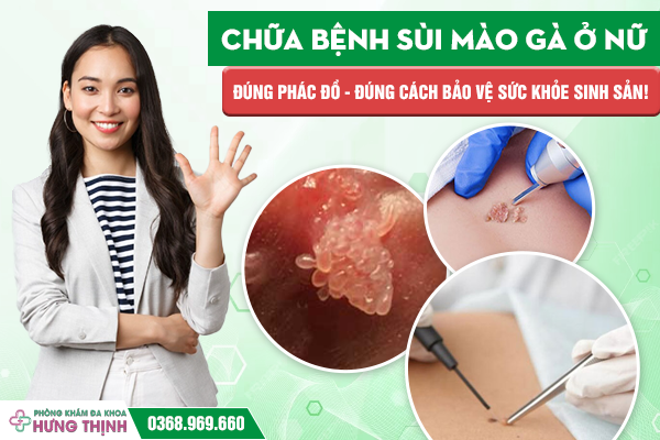 Chữa Bệnh Sùi Mào Gà Ở Nữ: Đúng Phác Đồ – Đúng Cách – Bảo Vệ Sức Khỏe Sinh Sản!