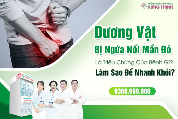 Dương Vật Bị Ngứa Nổi Mẩn Đỏ Triệu Chứng Của Bệnh Gì? Làm Sao Để Nhanh Khỏi?