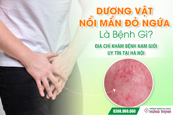 Dương Vật Nổi Mẩn Đỏ Ngứa Là Bệnh Gì? Địa Chỉ Khám Bệnh Nam Giới Uy Tín Tại Hà Nội