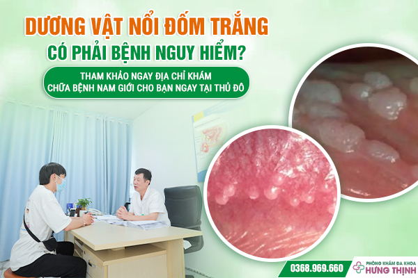 Dương Vật Nổi Đốm Trắng Có Phải Bệnh Nguy Hiểm? Tham Khảo Ngay Địa Chỉ Khám Chữa Bệnh Nam Giới Cho Bạn Ngay Tại Thủ Đô