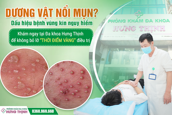Dương vật nổi mụn? Dấu hiệu bệnh vùng kín nguy hiểm. Khám ngay tại Đa khoa Hưng Thịnh để không bỏ lỡ “thời điểm vàng” điều trị