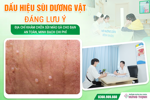 Dấu Hiệu Sùi Dương Vật Đáng Lưu Ý - Địa Chỉ Khám Chữa Sùi Mào Gà Cho Bạn An Toàn, Minh Bạch Chi Phí