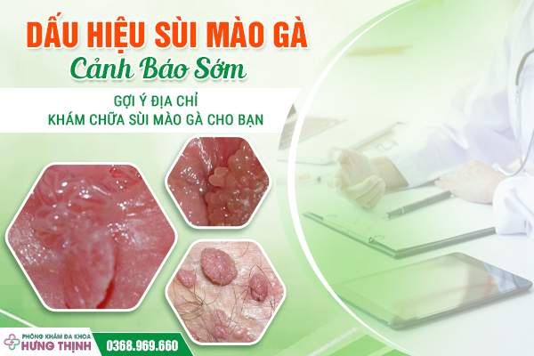 Dấu Hiệu Sùi Mào Gà Cảnh Báo Sớm - Gợi Ý Địa Chỉ Khám Chữa Sùi Mào Gà Cho Bạn