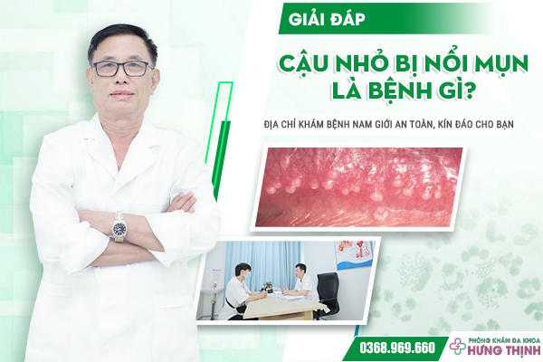 Giải Đáp: Cậu Nhỏ Bị Nổi Mụn Là Bệnh Gì? Địa Chỉ Khám Bệnh Nam Giới An Toàn, Kín Đáo Cho Bạn
