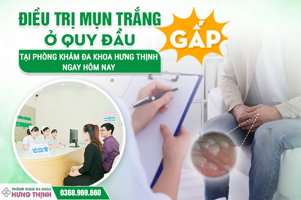 [GẤP] Điều Trị Mụn Trắng Ở Quy Đầu Tại Phòng Khám Đa Khoa Hưng Thịnh Ngay Hôm Nay