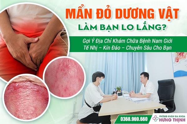 Mẩn Đỏ Dương Vật Làm Bạn Lo Lắng? Gợi Ý Địa Chỉ Khám Chữa Bệnh Nam Giới Tế Nhị – Kín Đáo – Chuyên Sâu Cho Bạn