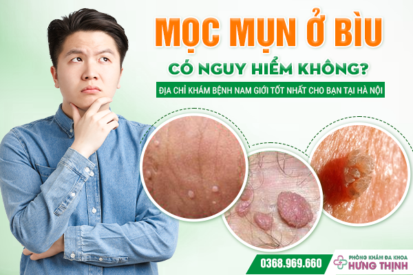 Mọc Mụn Ở Bìu Có Nguy Hiểm Không? Địa Chỉ Khám Bệnh Nam Giới Tốt Nhất Cho Bạn Tại Hà Nội