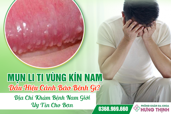 Mụn Li Ti Vùng Kín Nam: Dấu Hiệu Cảnh Báo Bệnh Gì? Địa Chỉ Khám Bệnh Nam Giới Uy Tín Cho Bạn
