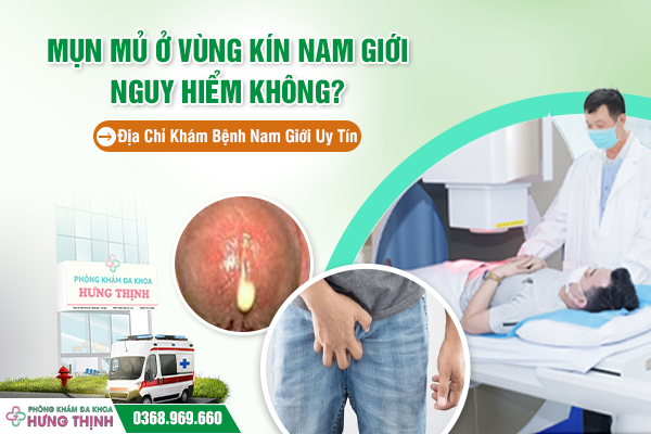 Mụn Mủ Ở Vùng Kín Nam Giới Nguy Hiểm Không? Địa Chỉ Khám Bệnh Nam Giới Uy Tín
