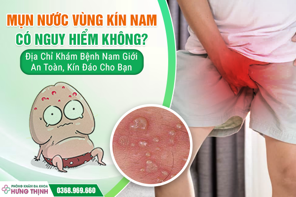 Mụn Nước Vùng Kín Nam Có Nguy Hiểm Không? Địa Chỉ Khám Bệnh Nam Giới An Toàn, Kín Đáo Cho Bạn