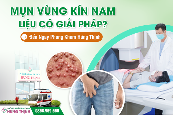 Mụn Nhọt Vùng Kín Nam Liệu Có Giải Pháp? Đến Ngay Phòng Khám Hưng Thịnh