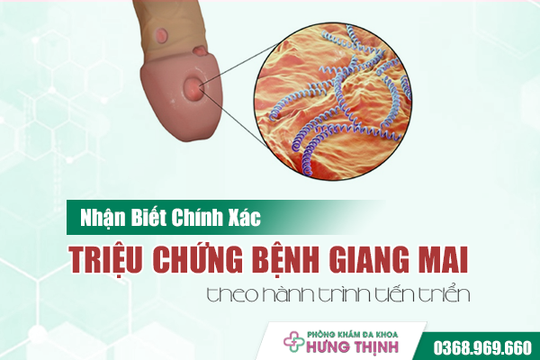 Nhận Biết Chính Xác Triệu Chứng Bệnh Giang Mai Theo Hành Trình Tiến Triển