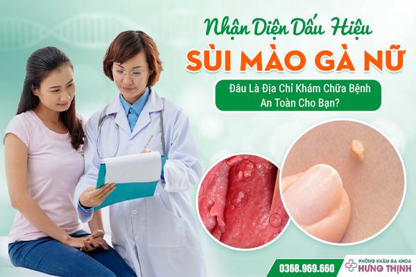 Nhận Diện Dấu Hiệu Sùi Mào Gà Nữ – Đâu Là Địa Chỉ Khám Chữa Bệnh An Toàn Cho Bạn?