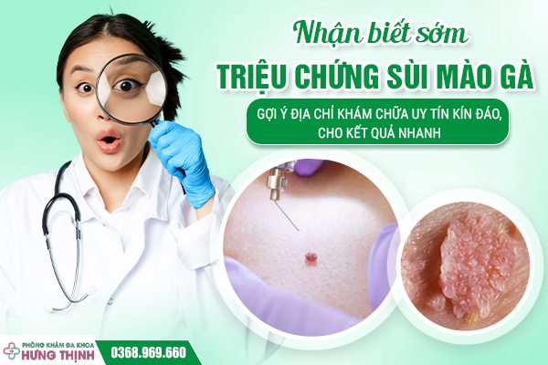 Nhận biết sớm triệu chứng sùi mào gà. Gợi ý địa chỉ khám chữa uy tín kín đáo, cho kết quả nhanh