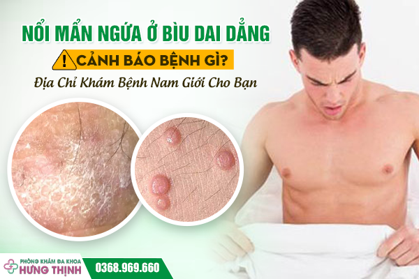 Nổi Mẩn Ngứa Ở Bìu Dai Dẳng Cảnh Báo Bệnh Gì? Địa Chỉ Khám Bệnh Nam Giới Cho Bạn