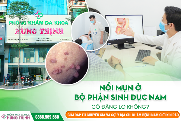 Nổi mụn ở bộ phận sinh dục nam có đáng lo không? Giải đáp từ chuyên gia và gợi ý địa chỉ khám bệnh nam giới kín đáo