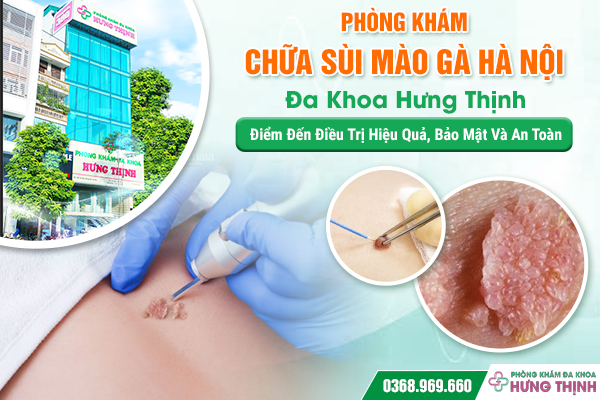 Phòng Khám Sùi Mào Gà Hà Nội - Đa Khoa Hưng Thịnh – Điểm Đến Điều Trị Hiệu Quả, Bảo Mật Và An Toàn