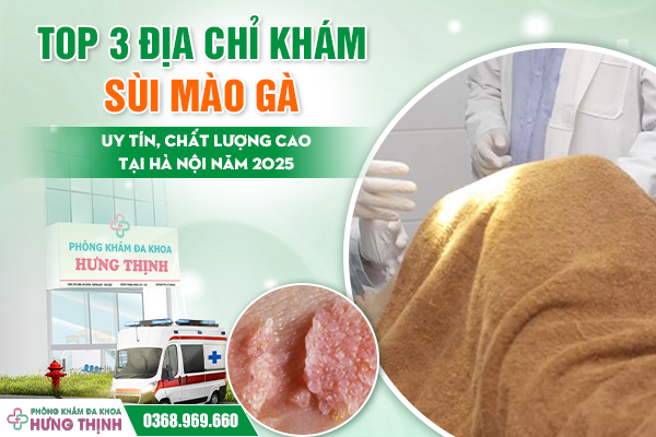 Top 3 Địa Chỉ Khám Sùi Mào Gà Uy Tín, Chất Lượng Cao Tại Hà Nội Năm 2025
