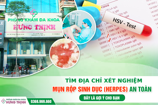 Tìm Địa Chỉ Xét Nghiệm Mụn Rộp Sinh Dục (Herpes) An Toàn – Đây Là Gợi Ý Cho Bạn 
