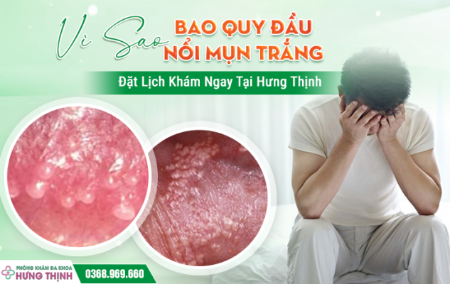 Vì Sao Bao Quy Đầu Nổi Mụn Trắng? Đặt Lịch Khám Ngay Tại Hưng Thịnh