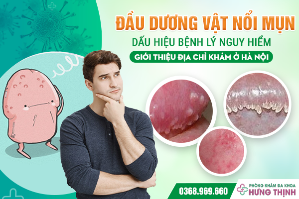 Đầu Dương Vật Nổi Mụn: Dấu Hiệu Bệnh Lý Nguy Hiểm – Giới Thiệu Địa Chỉ Khám Ở Hà Nội