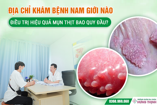 Địa Chỉ Khám Bệnh Nam Giới Nào Điều Trị Hiệu Quả Mụn Thịt Bao Quy Đầu?