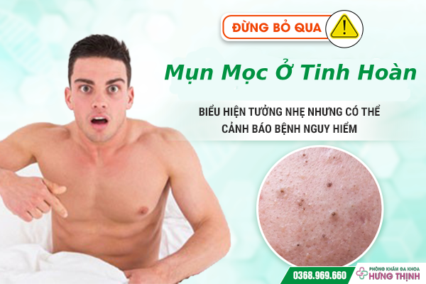 [ĐỪNG BỎ QUA] Mụn Mọc Ở Tinh Hoàn: Biểu Hiện Tưởng Nhẹ Nhưng Có Thể Cảnh Báo Bệnh Nguy Hiểm