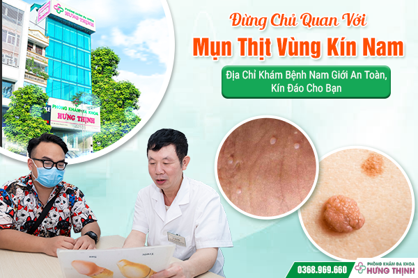 Đừng Chủ Quan Với Mụn Thịt Vùng Kín Nam – Địa Chỉ Khám Bệnh Nam Giới An Toàn, Kín Đáo Cho Bạn