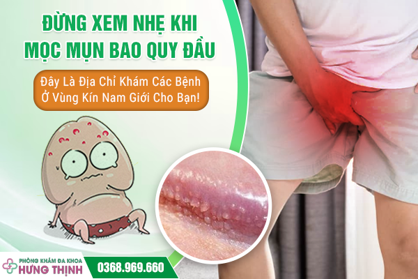 Đừng Xem Nhẹ Khi Mọc Mụn Bao Quy Đầu – Đây Là Địa Chỉ Khám Các Bệnh Ở Vùng Kín Nam Giới Cho Bạn!