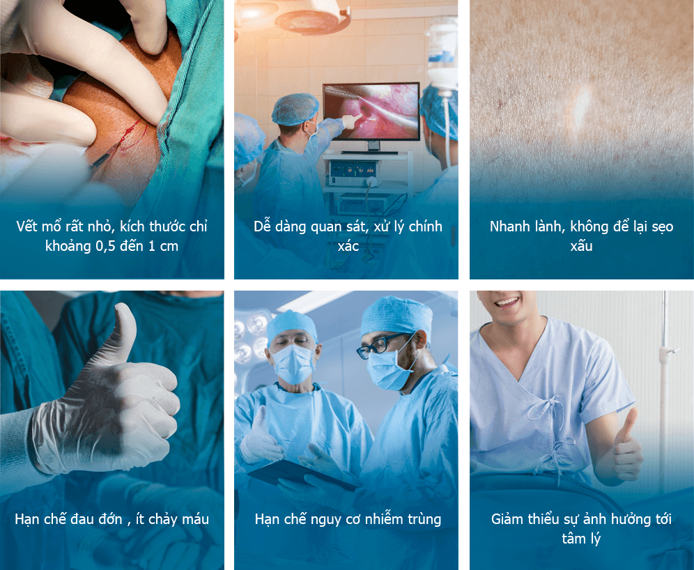Công Nghệ Tiểu Phẫu - Xâm Lấn Tối Thiểu